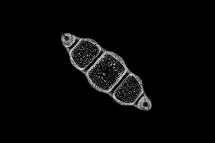 black and white microscopic view of a diatom