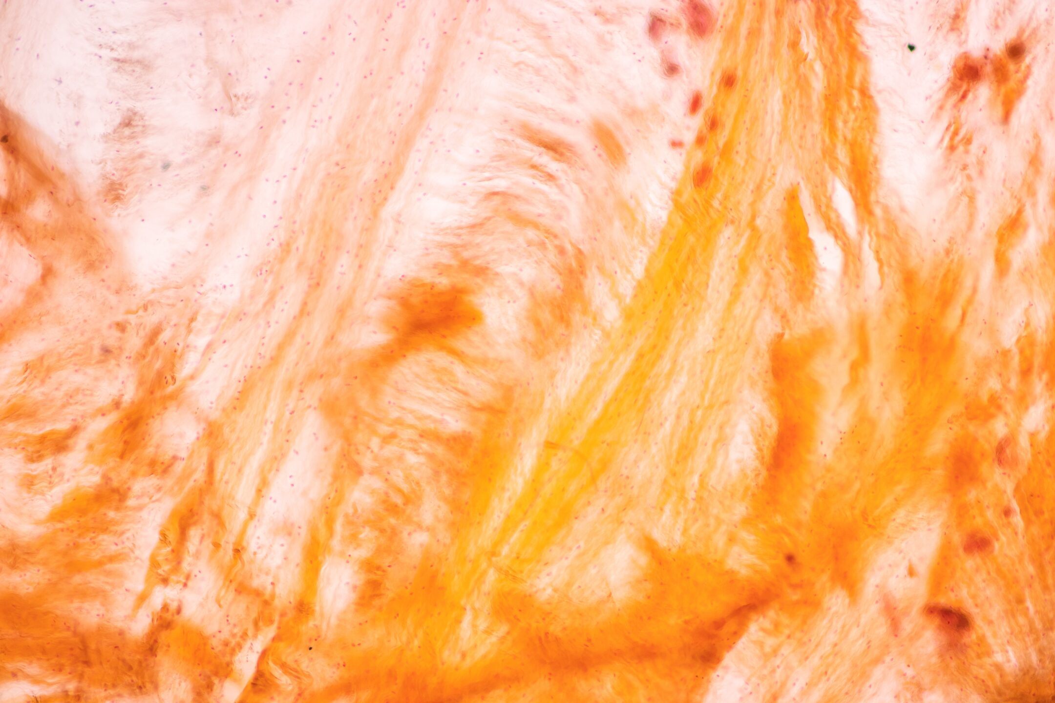 A microscopic image shows fibers and cartilage intermingled.